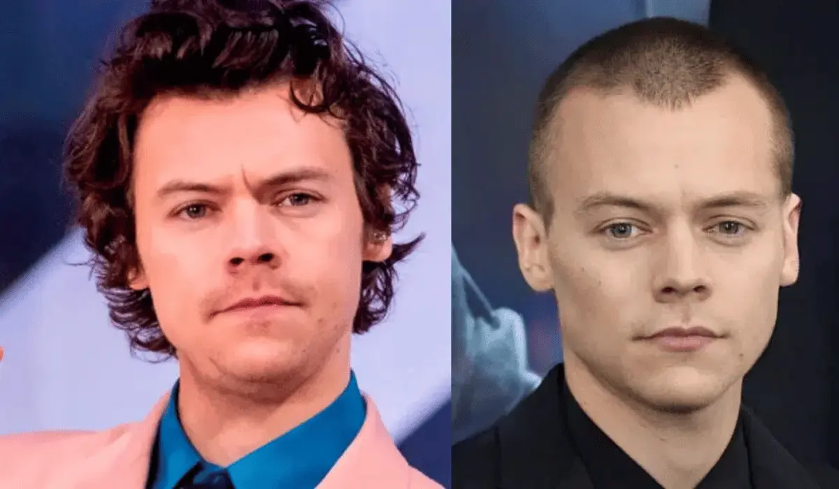 Harry Styles Hair and Hairline Review