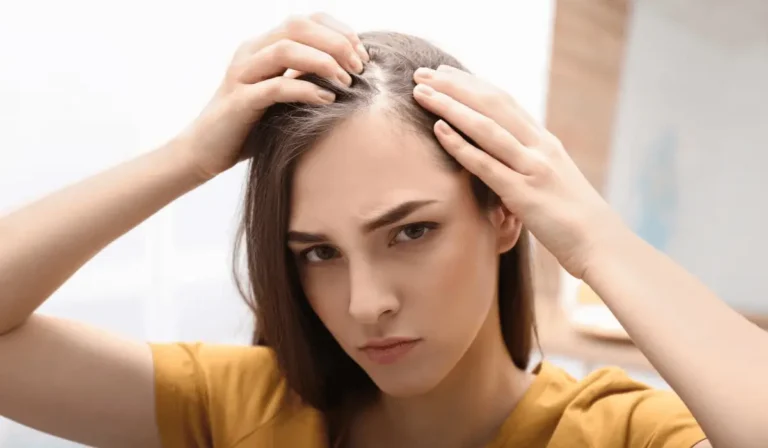 Receding Hairline in Women: Causes and Fixes